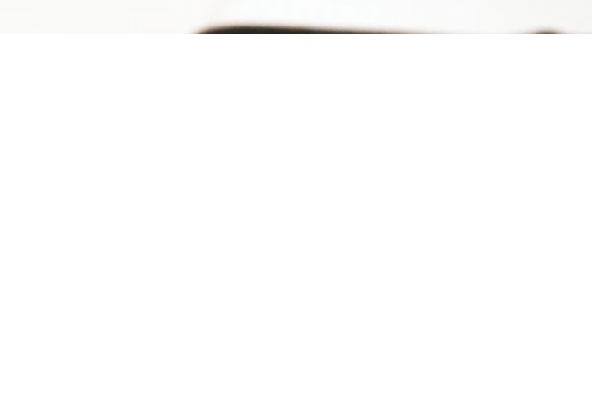 Cat Anxiety 2025: Signs, Causes & How to Calm Your Cat 🐱